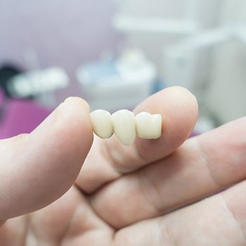 A modern dental bridge held in a grayed hand