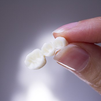 A traditional dental bridge held between two fingers