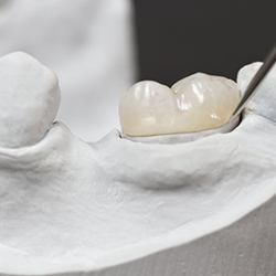 an example of a dental crown on a wax model